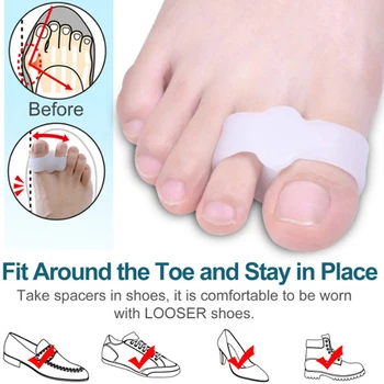 2 ЕЛЕМЕНТА Силиконов разделител за пръсти на крака Коректор вальгусной деформация, За облекчаване на болки в краката
